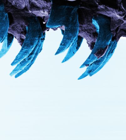 Dale un vistazo a las imágenes de un microscopio electrónico de barrido que muestran filas de dientes de lapa y que, según descubrieron investigadores del Reino Unido, son la sustancia más fuerte que el hombre conoce. 
