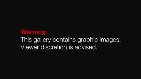 graphic warning - multiple images