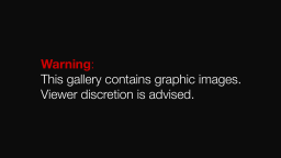 graphic warning - multiple images