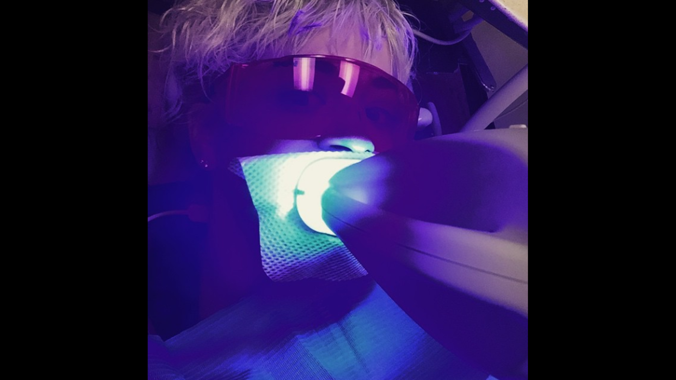 Singer Rita Ora gets her teeth whitened in this selfie <a href="https://instagram.com/p/zRB217xs9F/?modal=true" target="_blank" target="_blank">she posted to Instagram</a> on Wednesday, February 18. 