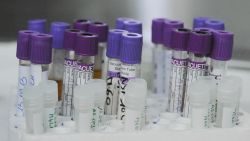 aman science lab vials