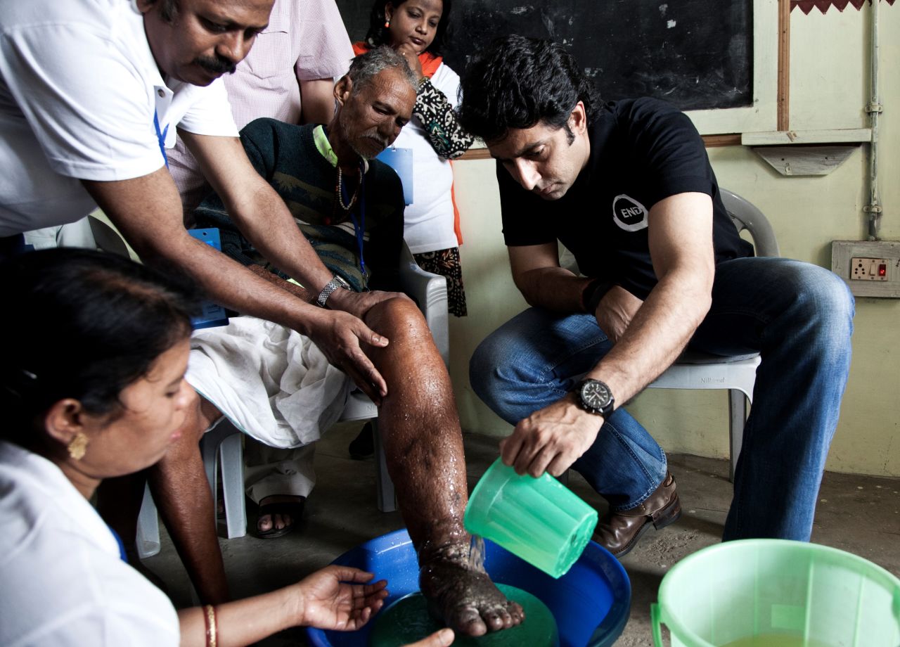The only option once patients have the severe swelling characteristic of elephantiasis is to manage symptoms by draining fluid where possible or else to keep limbs and wounds clean.