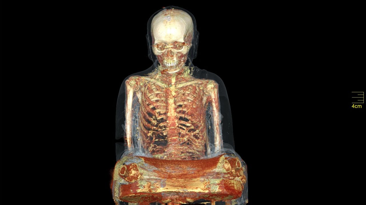 A CT scan of the golden statue.