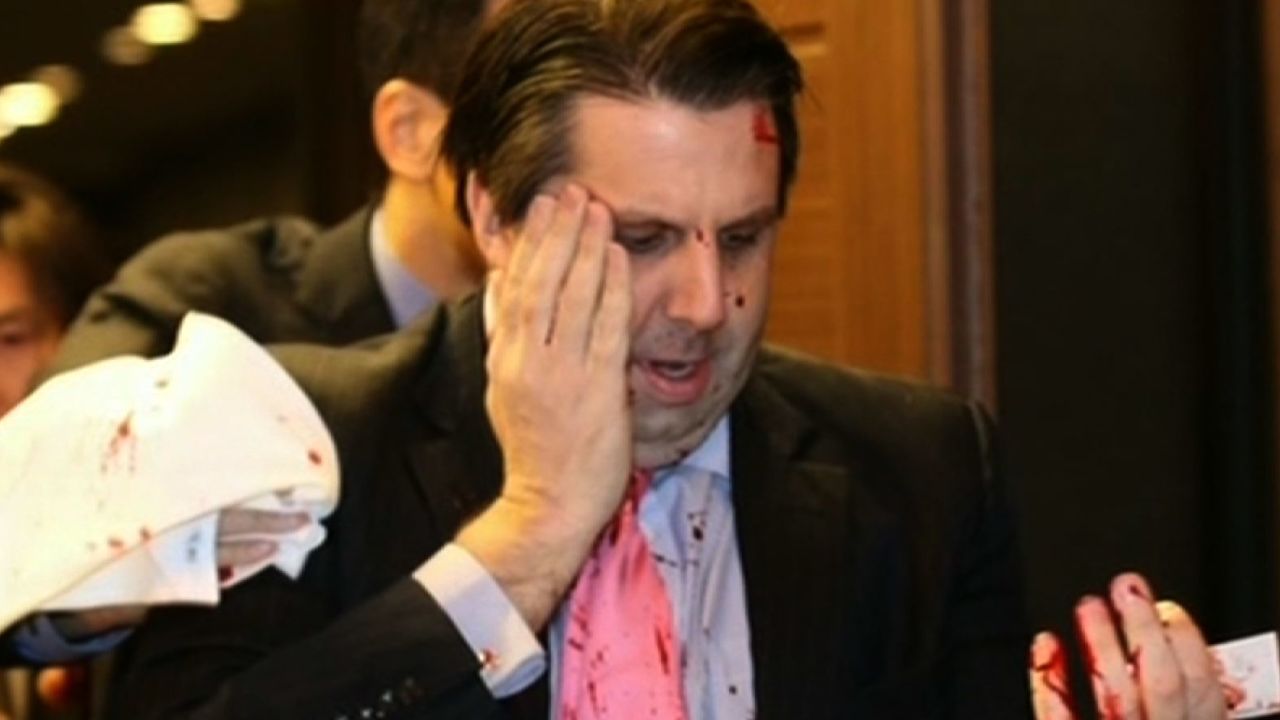 Mark Lippert Attack