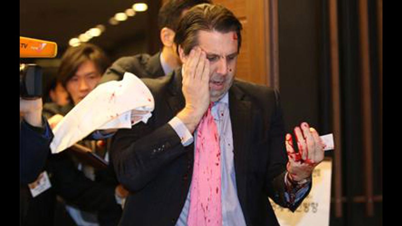 U.S. ambassador to South Korea Mark Lippert was stabbed in the face at an event in Seoul on March 5, 2015.