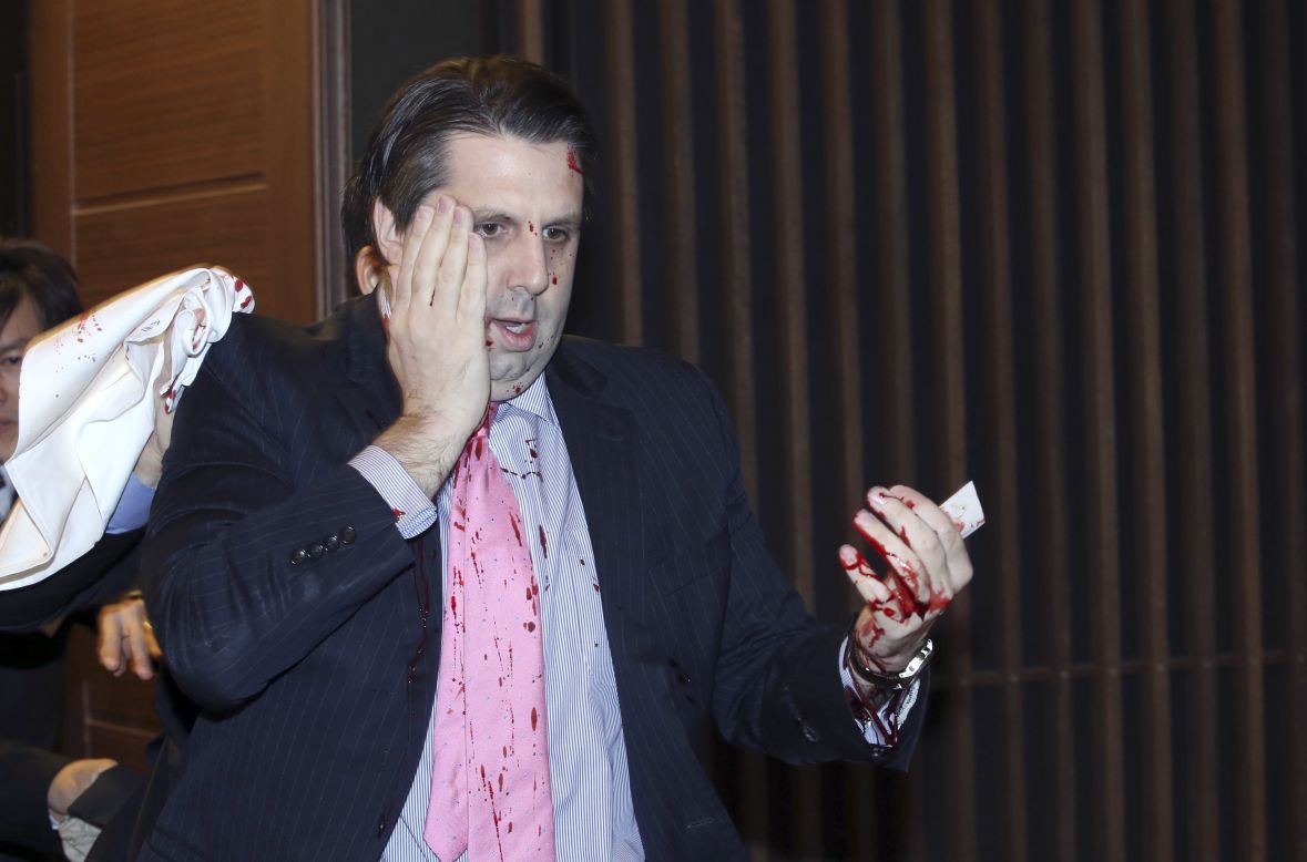 Mark Lippert, the U.S. ambassador to South Korea, leaves for a hospital after he was attacked Thursday, March 5, in Seoul, South Korea. According to Seoul police, <a href="http://www.cnn.com/2015/03/04/politics/ambassador-attacked-south-korea/index.html" target="_blank">Lippert was slashed on his right cheek and hand</a> with a knife measuring about 10 inches long. They said the motive for the attack and how it was organized are under investigation.