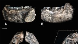 This image provided by William Kimbel shows different views of the LD 350-1 mandible. The scale bars indicate 1 cm. The jawbone fragment is the oldest known fossil from an evolutionary tree branch that eventually led to modern humans, scientists reported on Wednesday, March 4, 2015. At about 2.8 million years old, the partial jawbone pushes back the fossil record by at least 400,000 years for our branch, which scientists call Homo. (AP Photo/William Kimbel)
