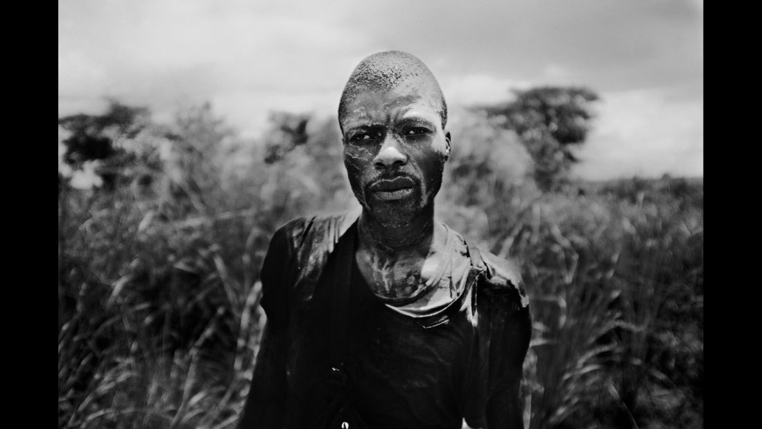 A man in shock after his truck fell over in the mud on the way to the city of Kikwit.