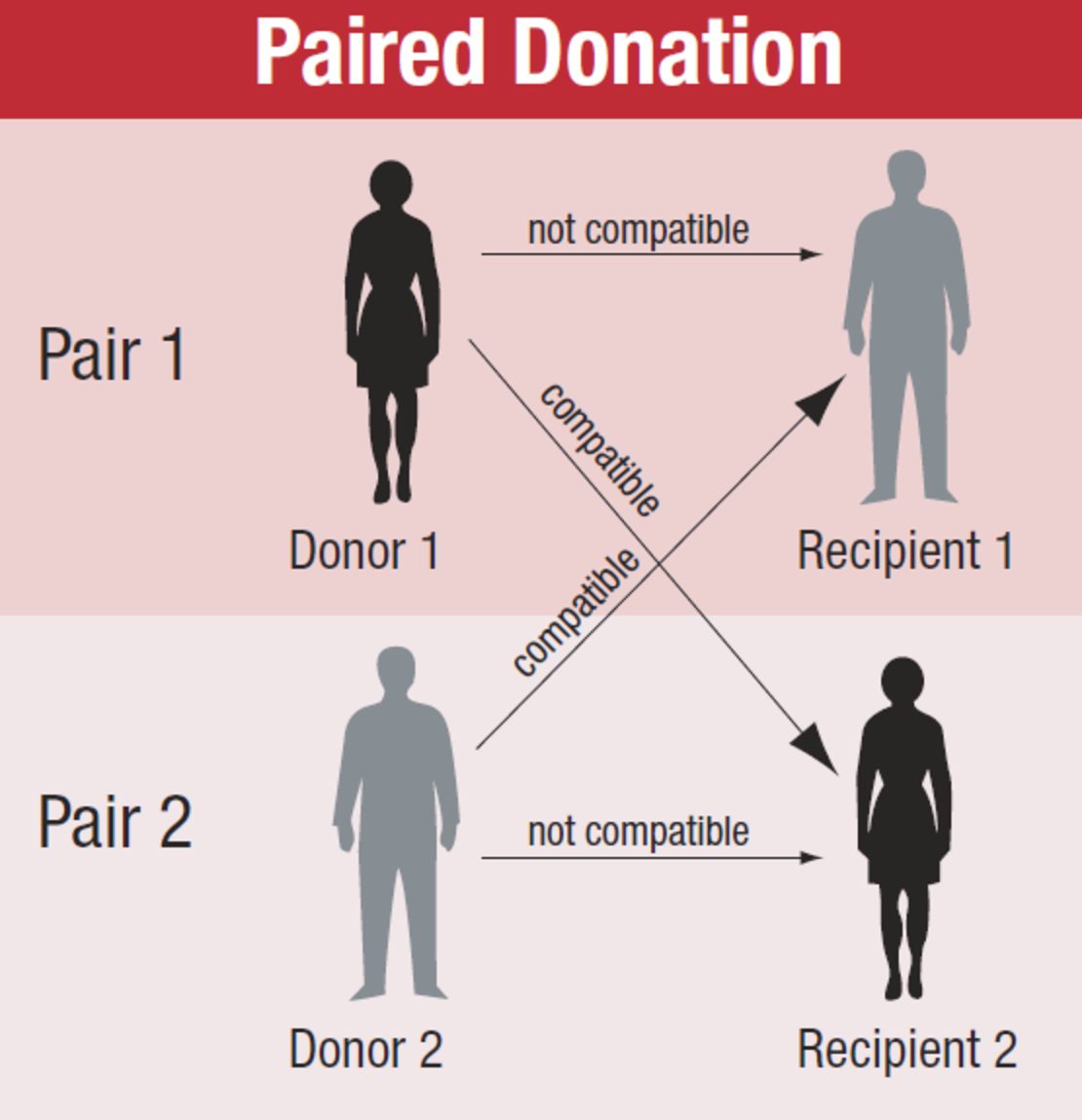 If a donor's kidney doesn't match up with a recipient, the two can seek out a second donor-recipient pair and trade donations.