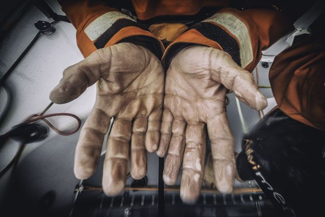 Sailor Ryan Houston shows off his prune-like hands after a morning of heavy rain. 