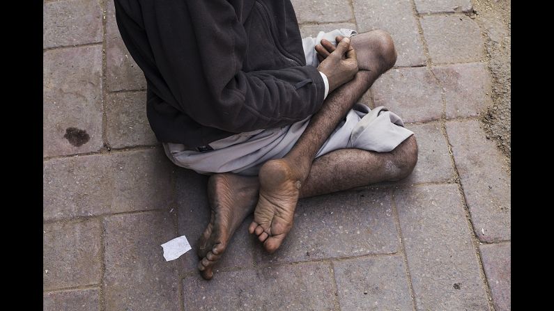 Emtiach lies on a street in New Delhi, begging for money in November. His left leg is thin and powerless because of polio. He came to the city from Bihar, one of the states that used to be most affected by polio. His wife is also affected by the disease.