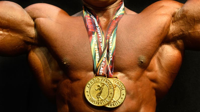 Atif Anwar poses with his medals after winning the Arnold Classic bodybuilding competition Sunday, March 15, in Melbourne.