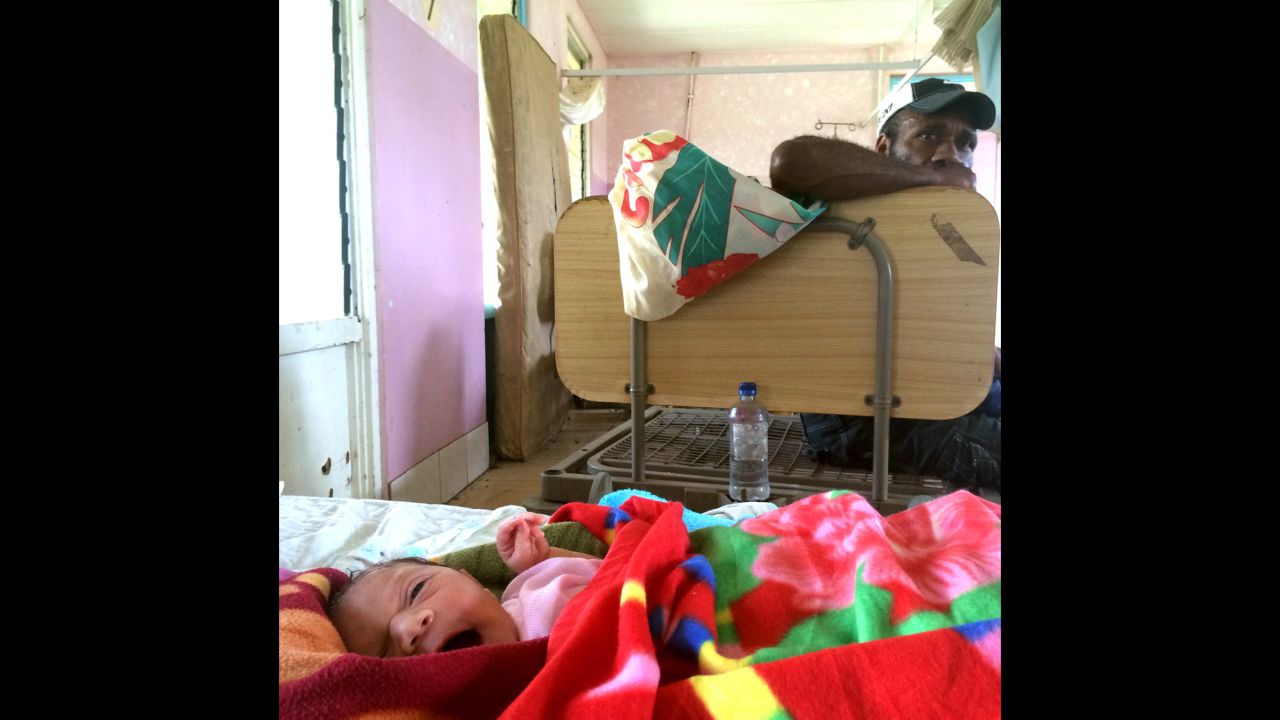 Ron Loman watches over his newborn baby, one day after birth at the storm-struck hospital on Tanna Island.