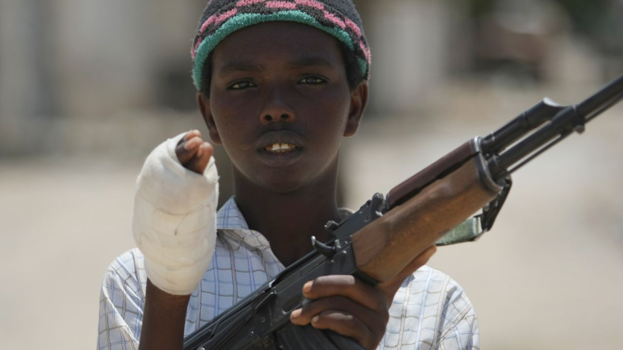 A young fighter from the Al-Shabaab militia shows his wounded hand after battling Somali government forces in Mogadishu in July 2009.
