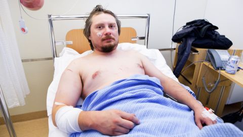 Jakub Moravec lies in his hospital bed after being attacked by a polar bear while sleeping in a tent.