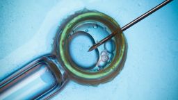 In vitro fertilisation, IVF macro concept