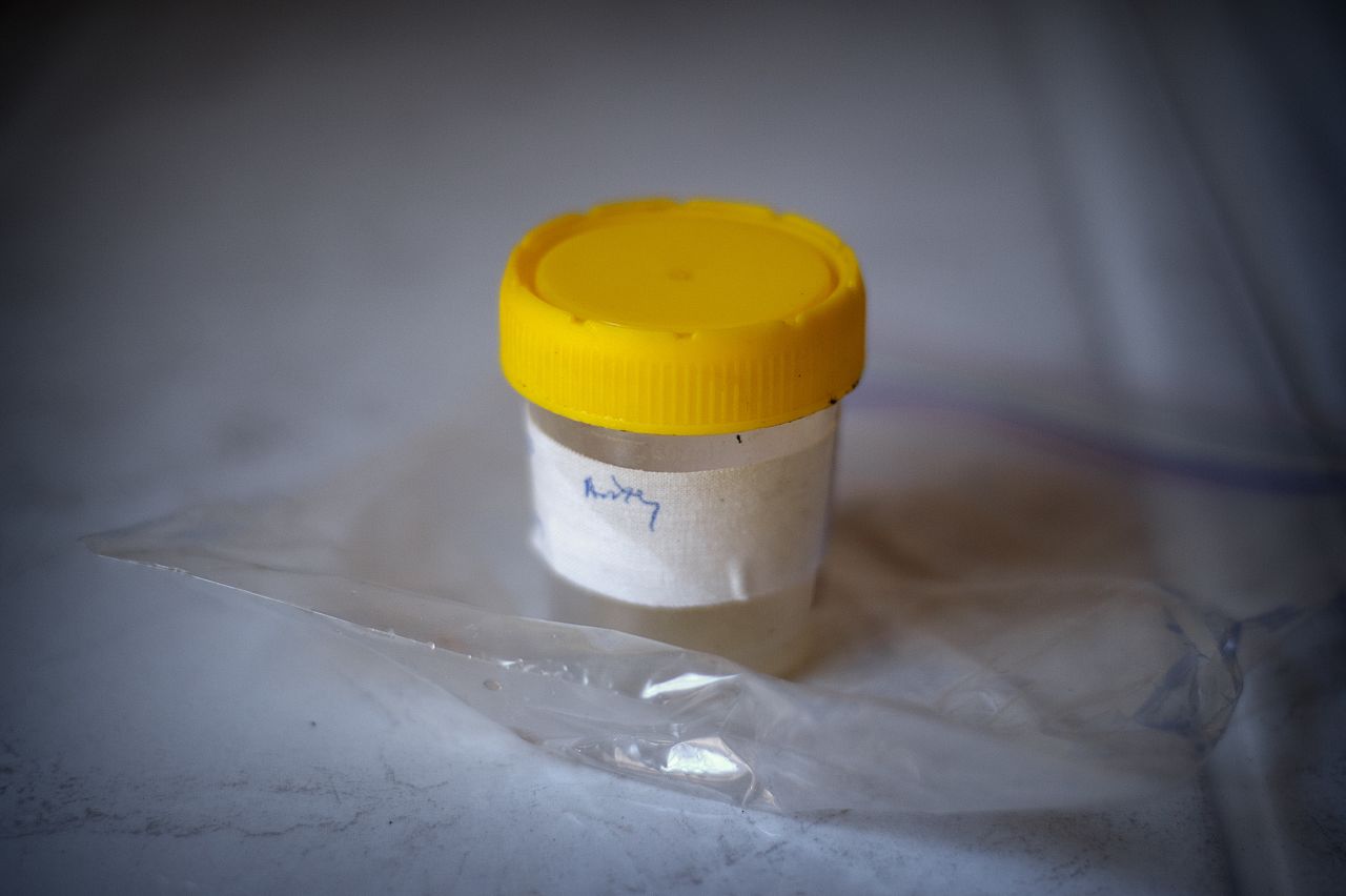 The main method of diagnosing TB is by testing samples of mucus -- known as sputum -- coughed up by patients suspected to be infected. Even when children are able to produce samples, detection of TB bacteria within the sample remains difficult due to low numbers present in the sample.