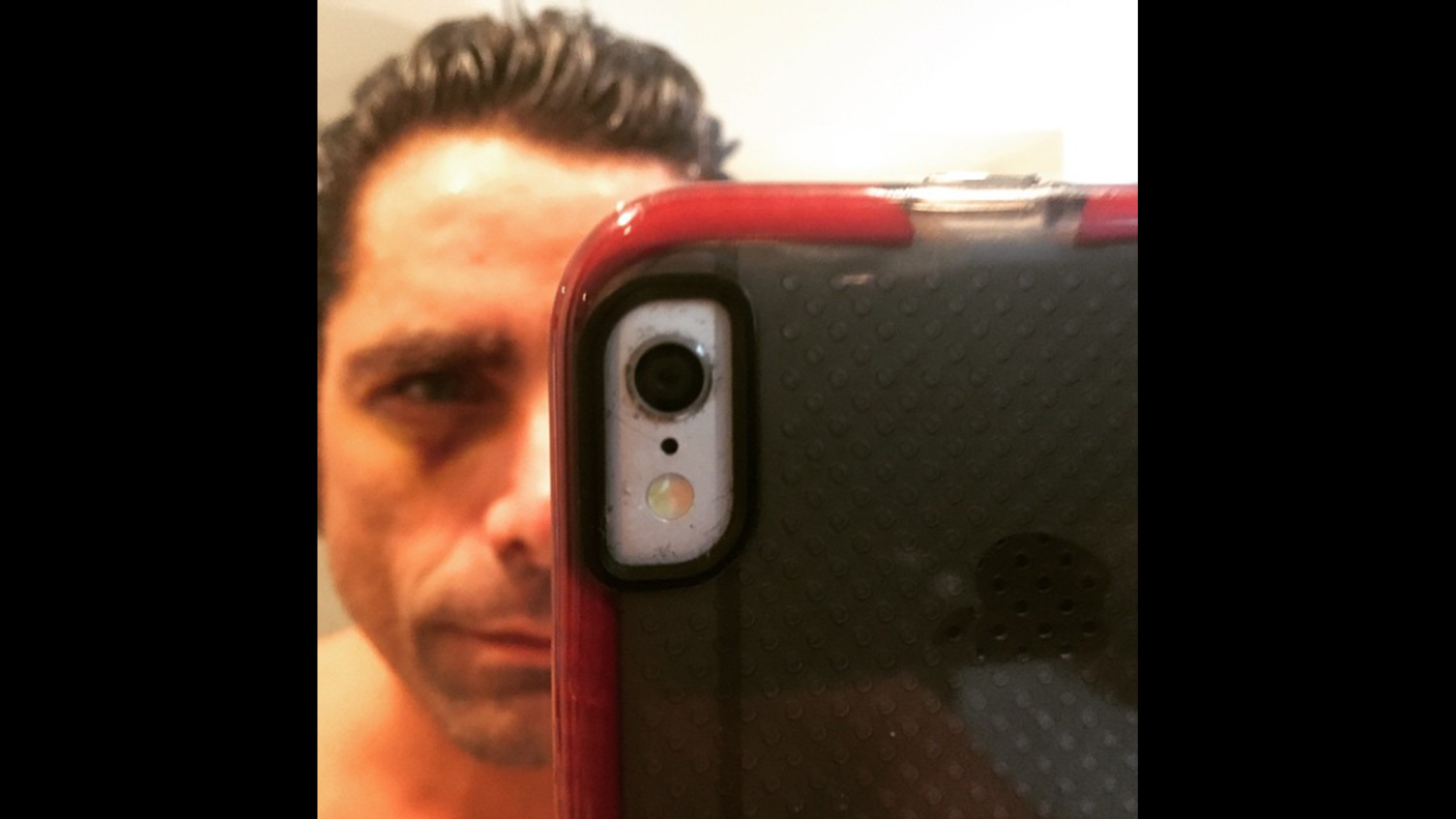 "Rockin' black eye first day of work," <a href="https://instagram.com/p/0fuapWCh95/?taken-by=johnstamos" target="_blank" target="_blank">actor John Stamos said</a> on Saturday, March 21. "Baller or Ratchet? (Or dumb)."