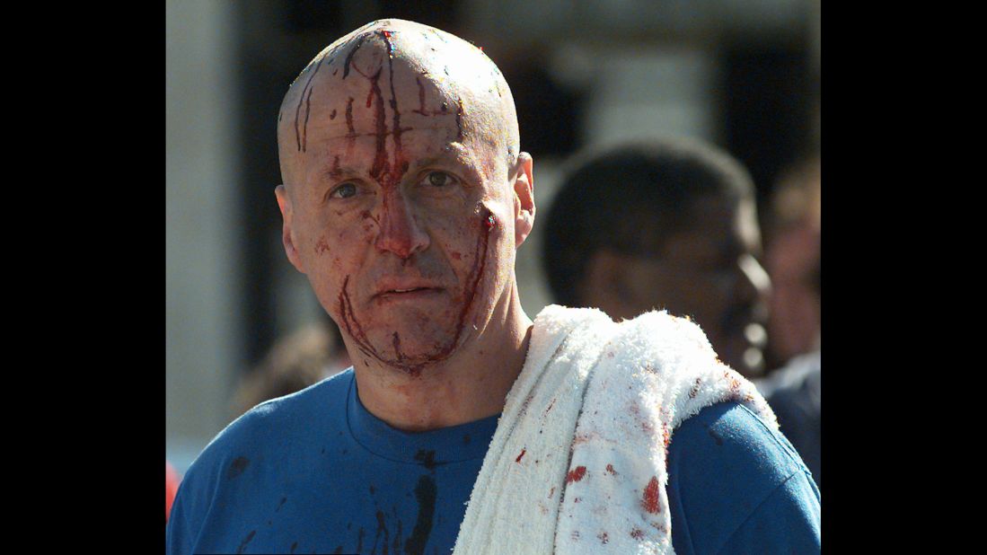 A man's face is covered with blood in the aftermath of the deadly bombing.
