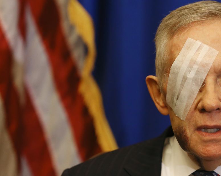 Reid's eye is bandaged while talking to reporters in 2015. Reid broke several ribs and bones in his face when a piece of exercise equipment he was using broke, causing him to fall.