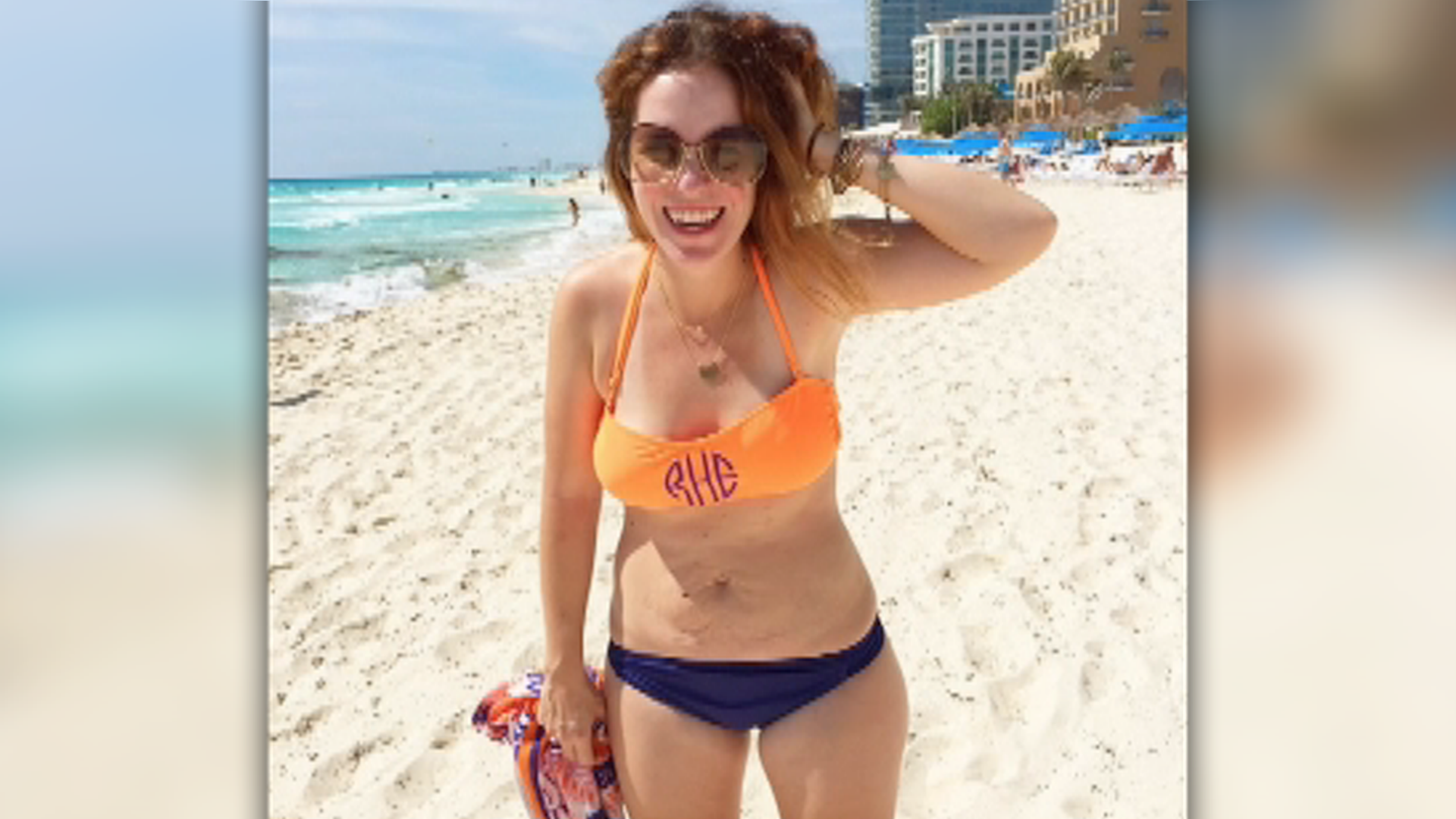 open haard Associëren Zeeanemoon Mom proud of 'flabby' bikini photo that went viral | CNN