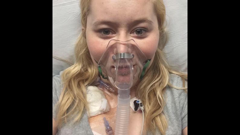 After months apart from Dalton, Katie found out she would receive a lifesaving lung transplant. She was able to briefly reunite with her husband afterward. She died at her home in Kentucky on September 22. She was 26.