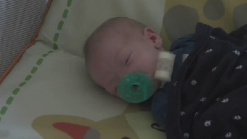 pkg baby born without nose_00012418.jpg