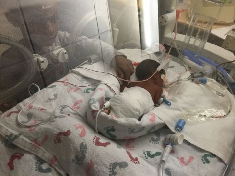 "She was just so amazed at how tiny he was." -- <a href="http://ireport.cnn.com/docs/DOC-1231778">Anita Thomas</a>, Pittsburgh, Pennsylvania (Baby King, born three months early, is still in the NICU but thriving.) 