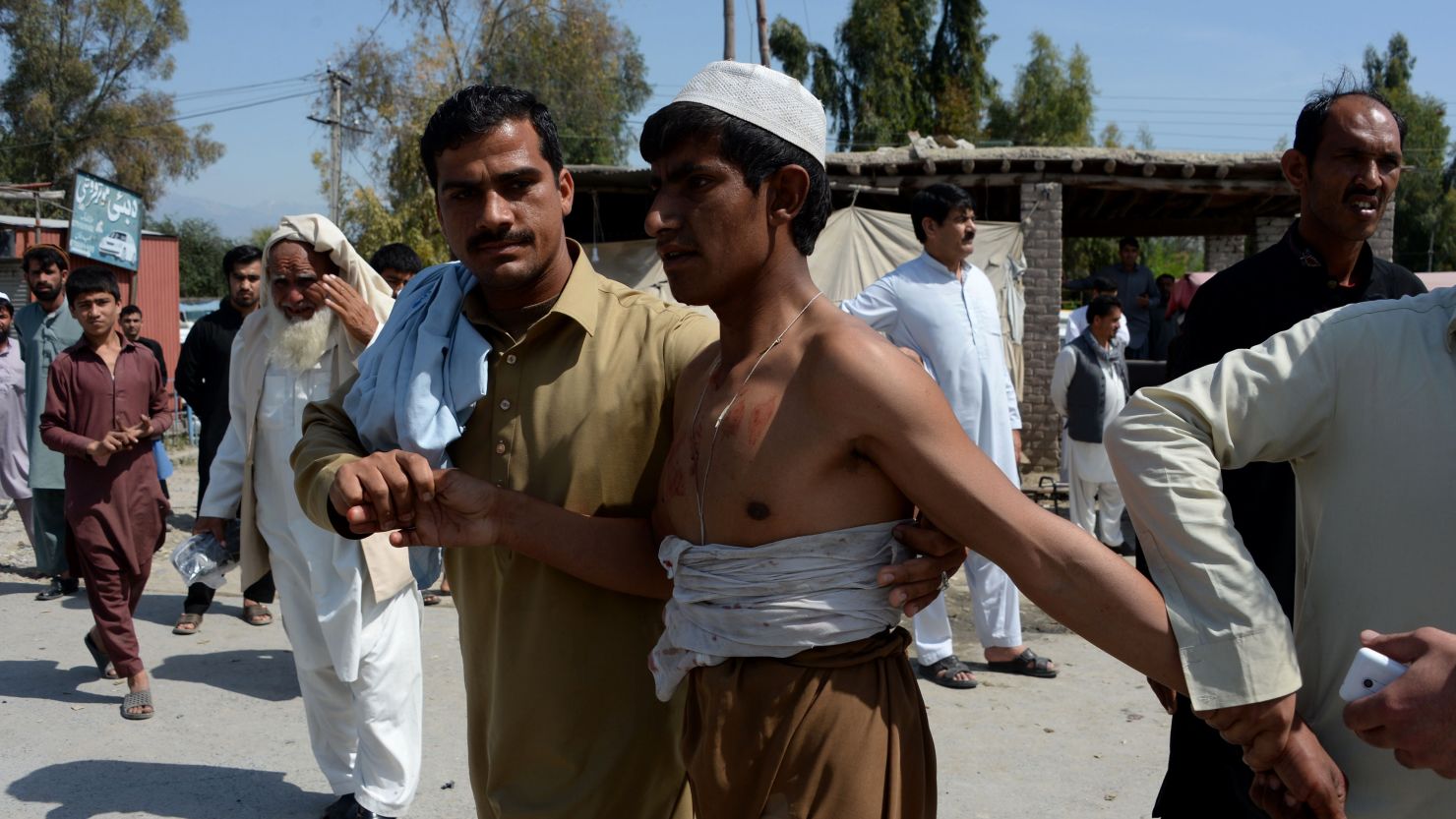 Afghan residents assist a wounded man after a suicide car bomb targeted a NATO convoy in Jalalabad.