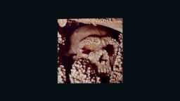 Altamura Man is the oldest Neanderthal to have his DNA extracted