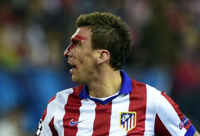 Mario Mandzukic was left with blood streaming from his face after a second half clash with Sergio Ramos.