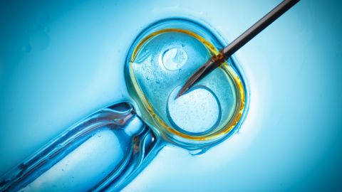 In in-vitro fertilization, sperm and eggs are removed from each parent and mixed together in a lab.