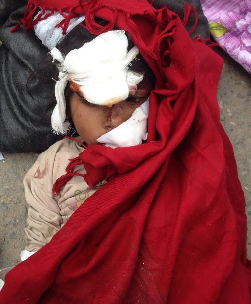 An injured child lies on the ground outside a hospital in Kathmandu on April 25.