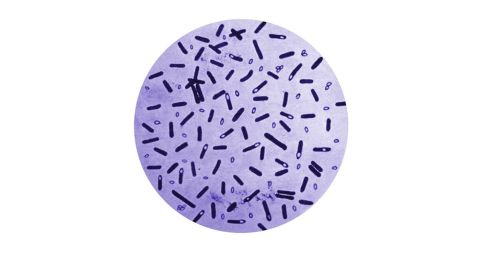 Clostridium botulinum bacteria are found in soil. It causes about 145 cases of human illness a year in the U.S.