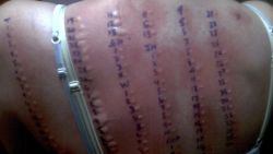 orig allergic to life brynn duncan mast cell activation syndrome_00010110.jpg