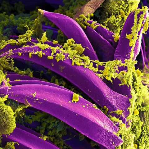 This is what causes the plague. <em>Yersinia pestis</em> bacteria, colored in yellow, are seen on the spines inside a flea's digestive system.