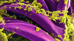 Purple-colored Yersinia pestis bacteria, the bacteria that causes the plague, seen on the spines of a flea.
