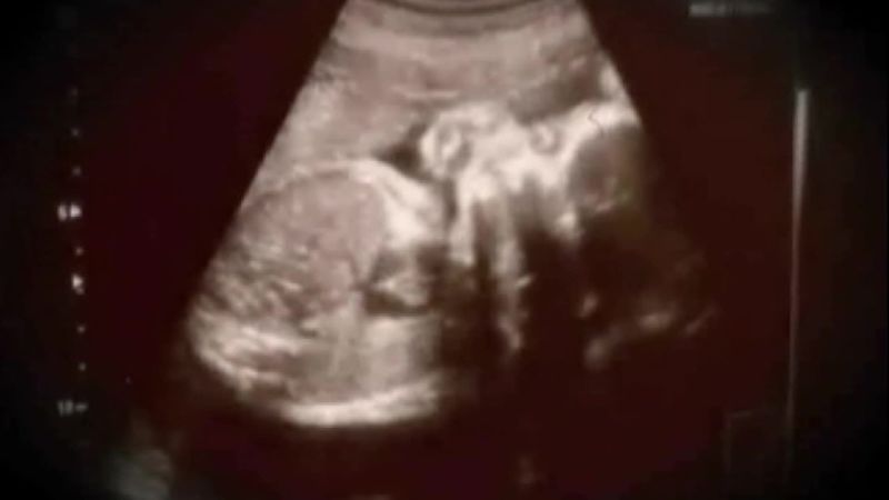 Group presses to allow abortion for raped 10-year-old