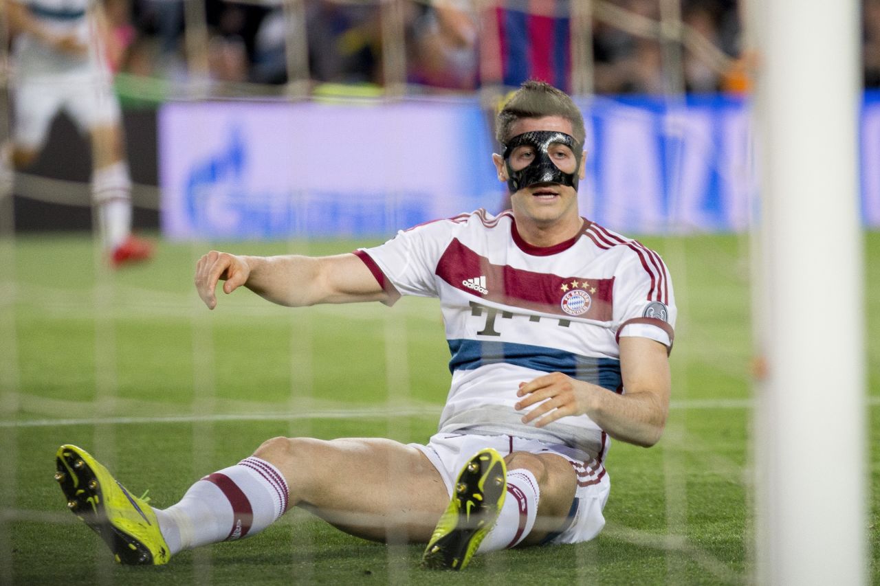 Robert Lewandowski of Bayern Munich -- coming off a broken jaw and nose sustained a week before -- is seen during the UEFA Champions League semi final match between FC Barcelona and FC Bayern Muenchen at Camp Nou Stadium on May 6, 2015 in Barcelona, Spain.