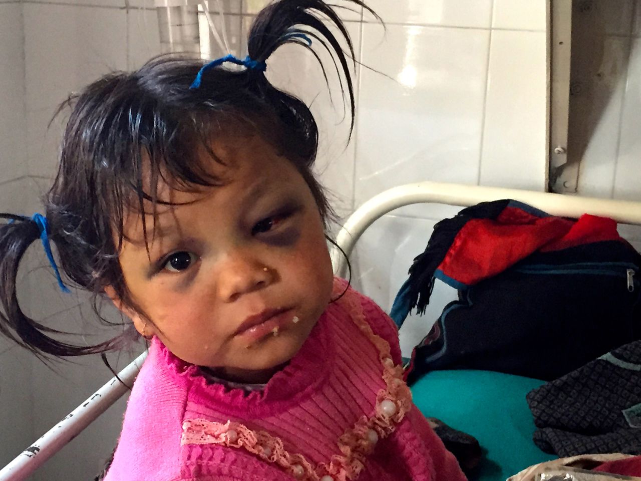 Maya's 5-year-old cousin Manisha was with her when the earthquake struck. She, too, was badly injured.