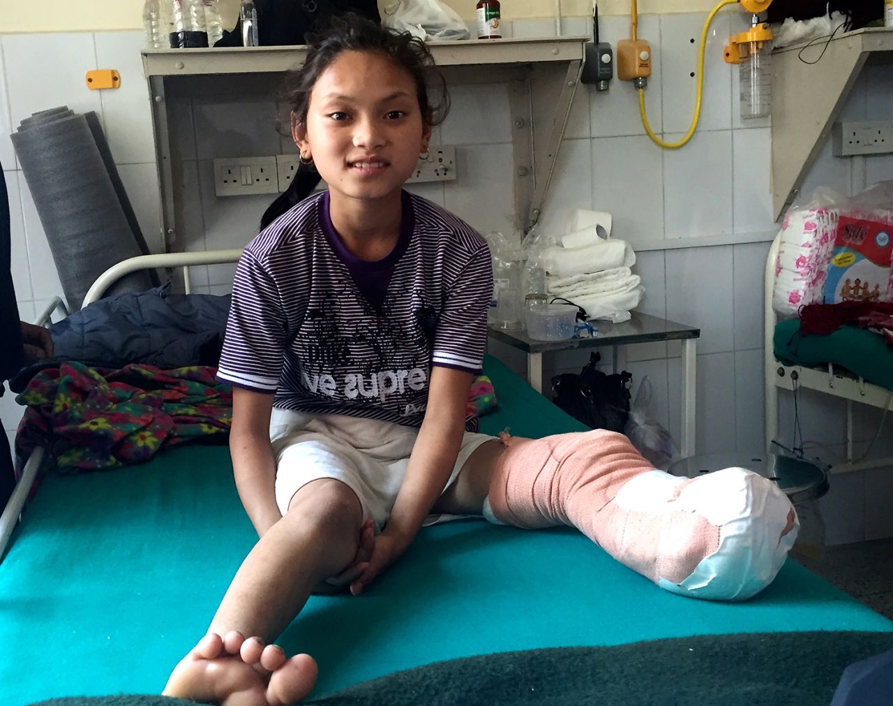 Maya is recovering well, but it's hard to say how she will fare once she returns home to her village in Nepal's Gorkha District, where the terrain is hilly and medical facilities are basic.