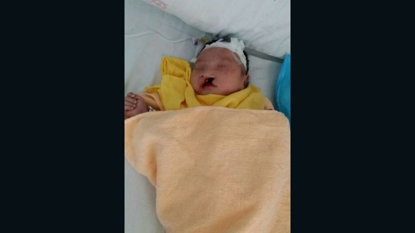 Police rescued a baby buried alive in a shallow, unmarked grave on the hillside in southern China's Guangxi province, Chinese state media has reported.