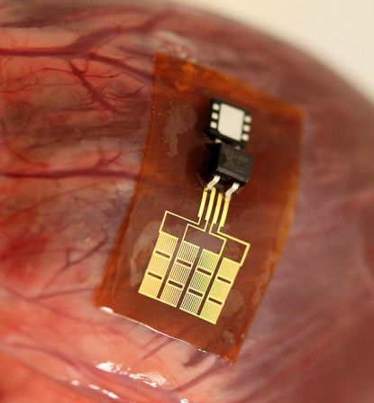 Flexible electronics can even be placed inside the body to learn more about organ health. They are being tested on rodents. 