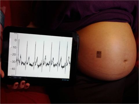 'Biostamp' technology is being used on pregnant mothers at University College San Diego to study the vital signs of their babies.