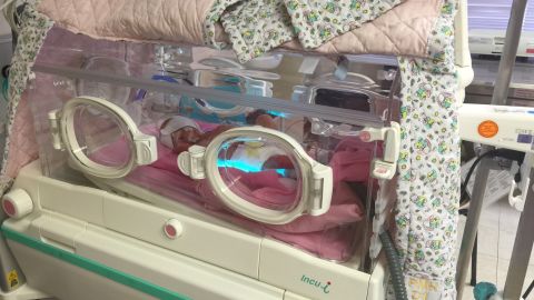 Kyuss Morrow, a baby born 8 weeks early, lies in an incubator at Princess Margaret Hospital in Hong Kong.