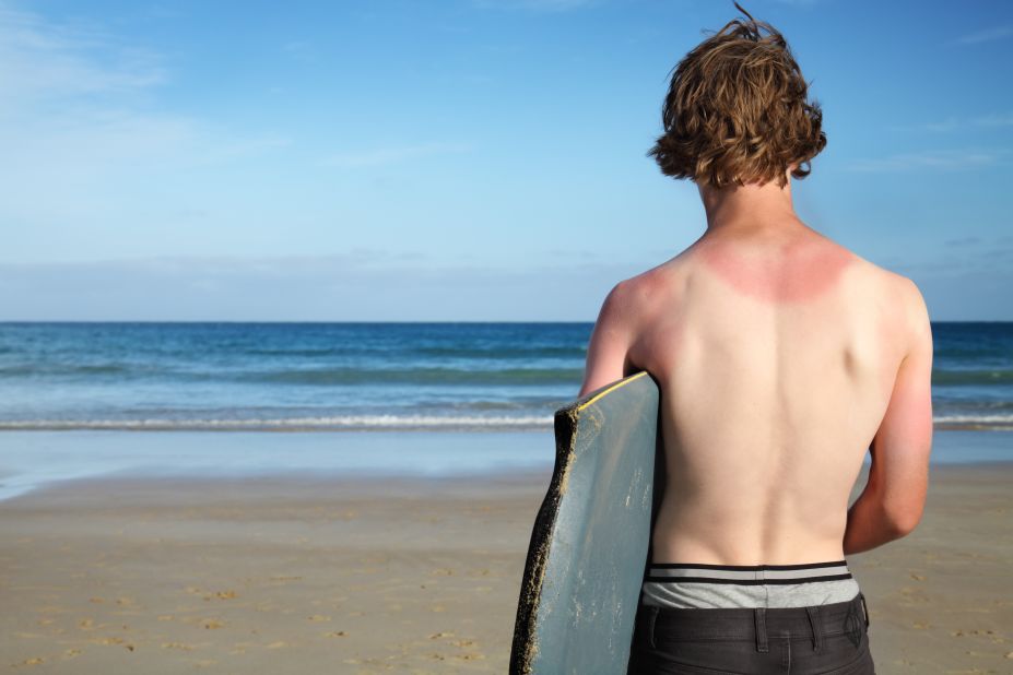 One key goal that research supports: avoid sunburns, no matter your age. Try to stay out of it during the hottest times of the day, usually 10 a.m. to 2 p.m., and wear protective clothing, a broad-brimmed hat and sunglasses. Behind the many joys of summer are hidden health hazards that threaten to slow you down. Click through our gallery to learn more about keeping yourself healthy.