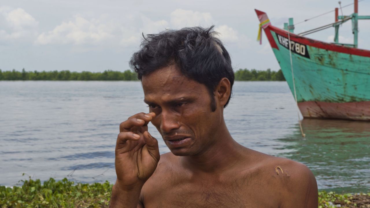 Bangladeshi migrant Mohammad Murad Hussein, with scars on his head and body, breaks down at Langsa port in Aceh, Indonesia after he was rescued by Indonesian fishermen.