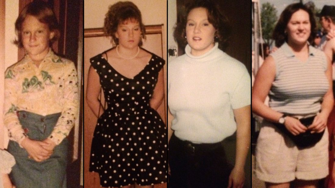 Candy Barone's self-sabotaging behavior has roots in her childhood. Through her teen years, twenties and into her early thirties, it increased, causing her weight to fluctuate. Click through our gallery to see her transformation. 