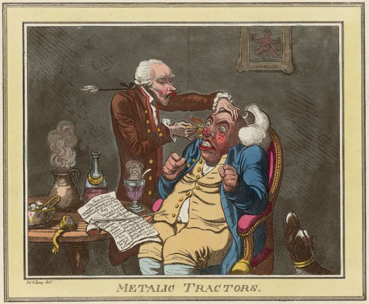 James Gillray's 1801 cartoon depicting a doctor using "metalic tractors" to lance boils. On the table, a publication says the tractors are a panacea for "red noses, gouty toes, windy bowels, broken legs and humpbacks."