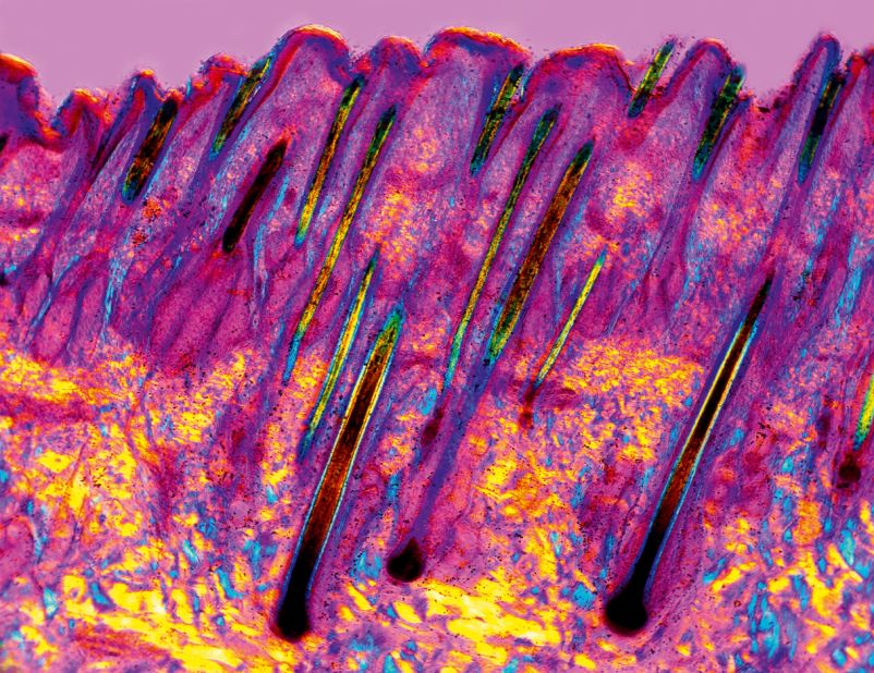 The outer layer of the skin, the epidermis (top half of this image) consists of dead cells that are constantly sloughed off and replaced from<br />below. These tightly packed cells contain high levels of a protein called keratin (yellow) which makes the skin waterproof and strong, to protect the organs inside. In this cross-section, you can also see hair follicles (black).